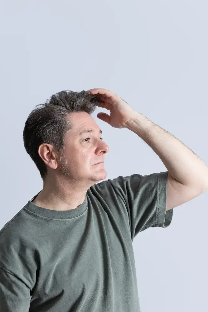 hair-system-Telogen-new-jersey-3