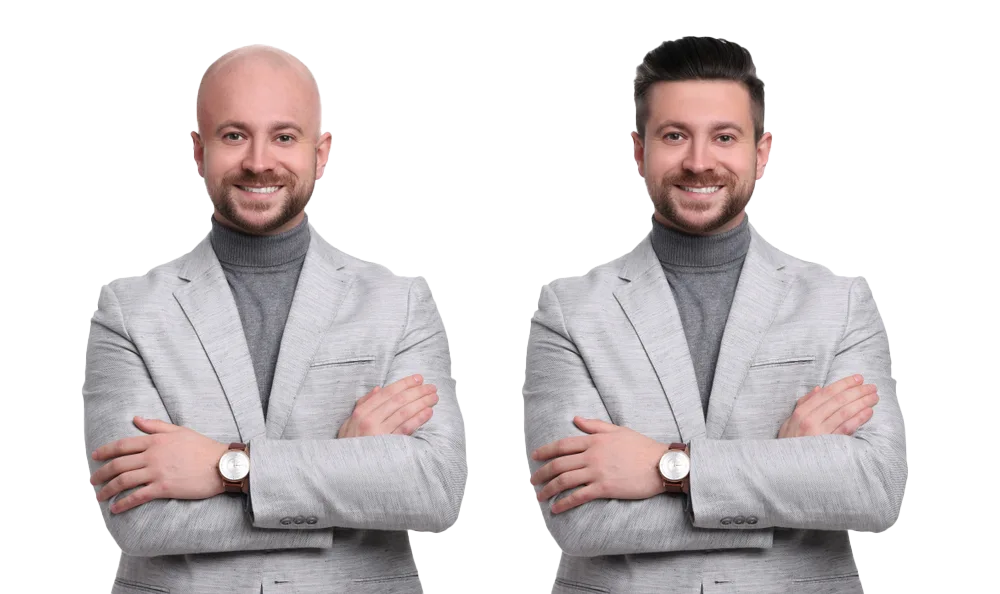Hair-System-Replacement-Toupee-Non-Surgical-New-Jersey-York (27)